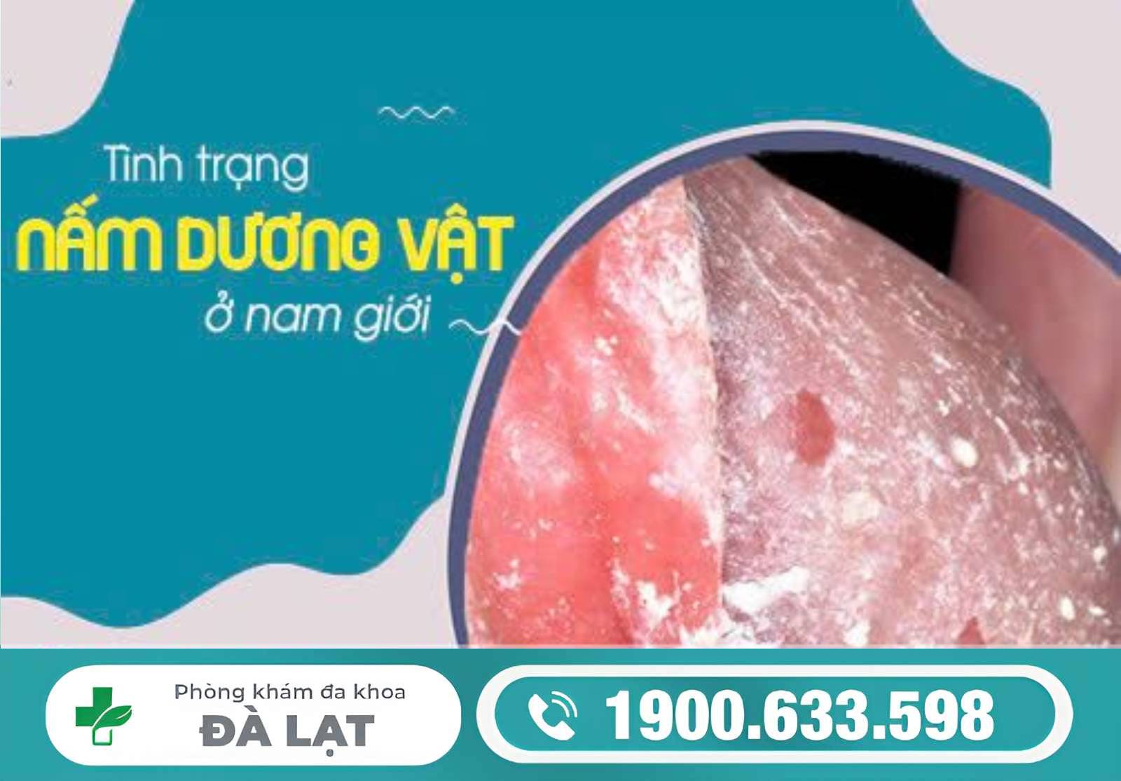 Hình ảnh minh họa